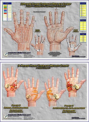 3-Phase Hand Reflex Therapy Charts