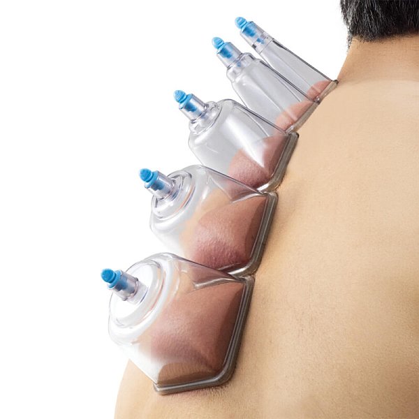 Fascia Buddy Squared Plastic Cupping Set, 20pc - Image 14