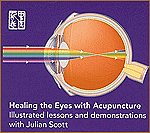 Healing the Eyes with Acupuncture DVD